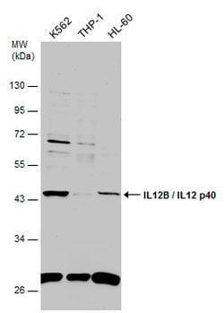 Invitrogen IL-12/IL-23 p40 Polyclonal Antibody 100 &mu;L; Unconjugated:Antibodies,