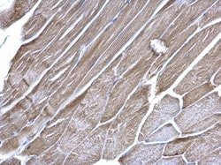 Invitrogen VDAC Polyclonal Antibody 100 &mu;L; Unconjugated:Antibodies,