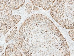 Invitrogen VDAC Polyclonal Antibody 100 &mu;L; Unconjugated:Antibodies,