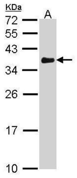 Invitrogen VDAC Polyclonal Antibody 100 &mu;L; Unconjugated:Antibodies,