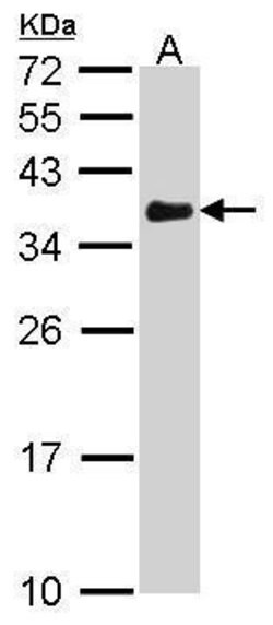 Invitrogen VDAC Polyclonal Antibody 100 &mu;L; Unconjugated:Antibodies,