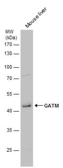 Invitrogen GATM Polyclonal Antibody 100 &mu;L; Unconjugated:Anticuerpos