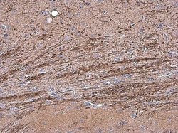 OMG Polyclonal Antibody:Antibodies, Polyclonal