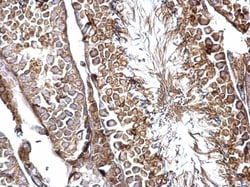 Invitrogen SH3GL3 Polyclonal Antibody 100 &mu;L; Unconjugated:Antibodies,