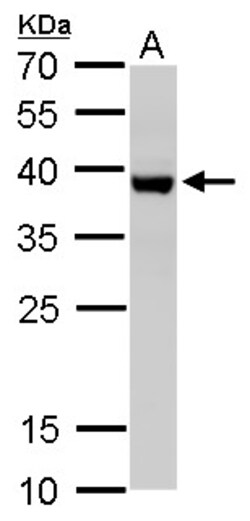 Invitrogen SH3GL3 Polyclonal Antibody 100 &mu;L; Unconjugated:Antibodies,