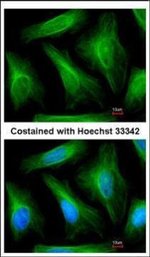TUBA1A Polyclonal Antibody, Invitrogen™