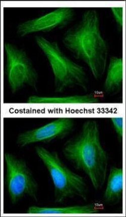 TUBA1A Polyclonal Antibody:Antibodies, Polyclonal