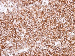 Invitrogen TUBA1A Polyclonal Antibody 100 &mu;L | Buy Online | Invitrogen&trade; | Fisher Scientific