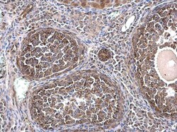Invitrogen TUBA1A Polyclonal Antibody 100 &mu;L | Buy Online | Invitrogen&trade; | Fisher Scientific