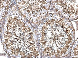 Invitrogen TUBA1A Polyclonal Antibody 100 &mu;L | Buy Online | Invitrogen&trade; | Fisher Scientific