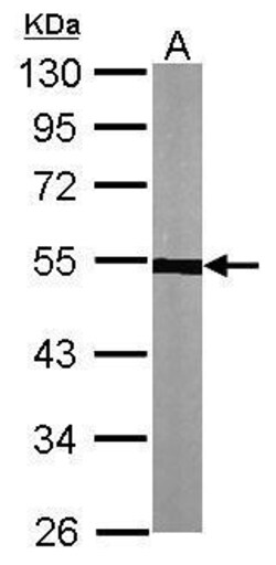 Invitrogen TUBA1A Polyclonal Antibody 100 &mu;L | Buy Online | Invitrogen&trade; | Fisher Scientific