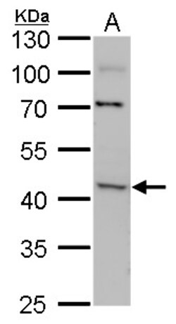 Invitrogen ACAA2 Polyclonal Antibody 100 &mu;L; Unconjugated:Antibodies,