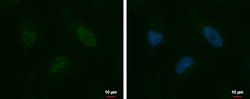 Invitrogen HELIOS Polyclonal Antibody 100 &mu;L; Unconjugated:Antibodies,