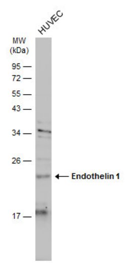 Invitrogen Endothelin 1 Polyclonal Antibody 100 &mu;L; Unconjugated:Antibodies,