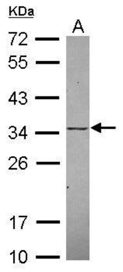 Invitrogen KChIP2 Polyclonal Antibody 100 &mu;L | Buy Online | Invitrogen&trade; | Fisher Scientific