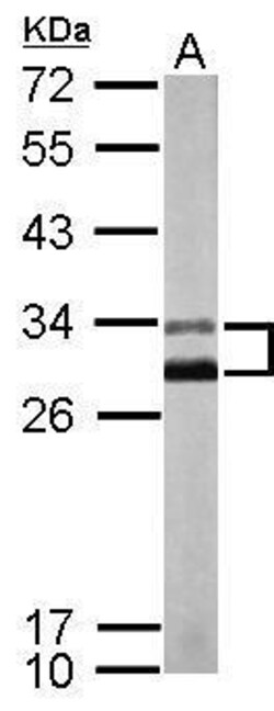 Invitrogen KChIP2 Polyclonal Antibody 100 &mu;L | Buy Online | Invitrogen&trade; | Fisher Scientific