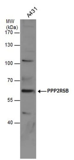 PPP2R5B Polyclonal Antibody, Invitrogen 100 &mu;L; Unconjugated:Antibodies,