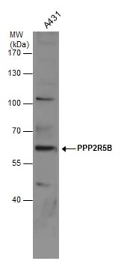 PPP2R5B Polyclonal Antibody, Invitrogen 100 &mu;L; Unconjugated:Antibodies,