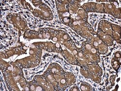 Invitrogen PATJ Polyclonal Antibody 100 &mu;L; Unconjugated:Antibodies,
