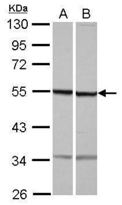 Invitrogen beta Tubulin Polyclonal Antibody 100 &mu;L; Unconjugated:Antibodies,