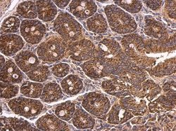 Invitrogen DAB1 Polyclonal Antibody 100 &mu;L; Unconjugated:Antibodies,