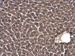 Invitrogen SKA1 Polyclonal Antibody 100 &mu;L; Unconjugated:Antibodies,