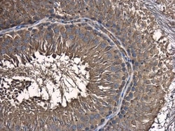 Invitrogen SKA1 Polyclonal Antibody 100 &mu;L; Unconjugated:Antibodies,