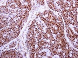 MAFF Polyclonal Antibody:Antibodies, Polyclonal