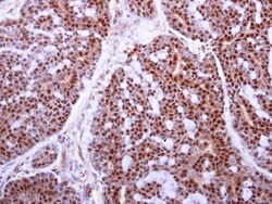 MAFF Polyclonal Antibody:Antibodies, Polyclonal
