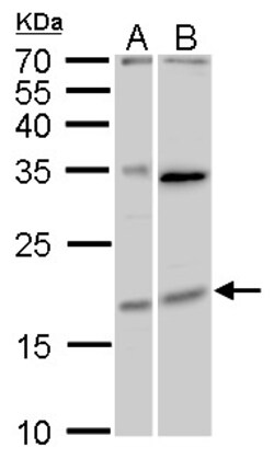 MAFF Polyclonal Antibody:Antibodies, Polyclonal