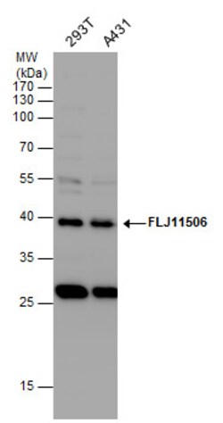 Invitrogen AAGAB Polyclonal Antibody 100 &mu;L; Unconjugated:Antibodies,