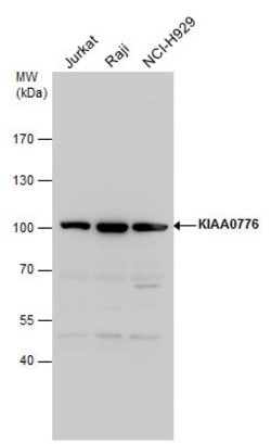 Invitrogen UFL1 Polyclonal Antibody 100 &mu;L; Unconjugated:Antibodies,