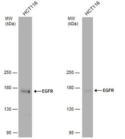 Invitrogen EGFR Polyclonal Antibody 100 &mu;L; Unconjugated:Antibodies,