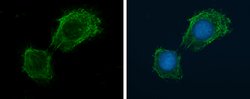 Invitrogen NOX4 Polyclonal Antibody 100 &mu;L; Unconjugated:Antibodies,