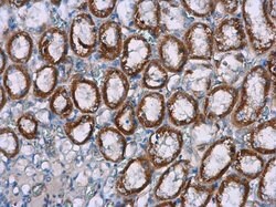 Invitrogen NOX4 Polyclonal Antibody 100 &mu;L; Unconjugated:Antibodies,
