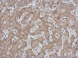 Invitrogen CPEB1 Polyclonal Antibody 100 &mu;L | Buy Online | Invitrogen&trade; | Fisher Scientific