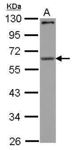 Invitrogen CPEB1 Polyclonal Antibody 100 &mu;L | Buy Online | Invitrogen&trade; | Fisher Scientific