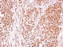 Invitrogen TET1 Polyclonal Antibody 100 &mu;L; Unconjugated:Antibodies,