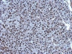 Invitrogen TET1 Polyclonal Antibody 100 &mu;L; Unconjugated:Antibodies,