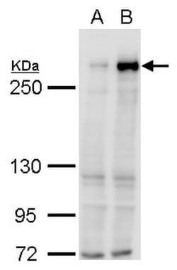 Invitrogen TET1 Polyclonal Antibody 100 &mu;L; Unconjugated:Antibodies,