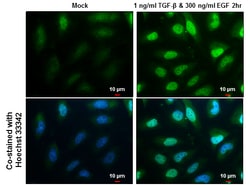Invitrogen SNAIL Polyclonal Antibody 100 &mu;L; Unconjugated:Antibodies,