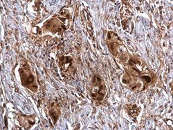 Invitrogen SNAIL Polyclonal Antibody 100 &mu;L; Unconjugated:Antibodies,