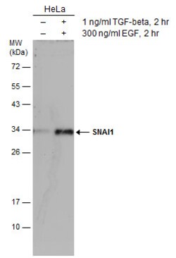 Invitrogen SNAIL Polyclonal Antibody 100 &mu;L; Unconjugated:Antibodies,