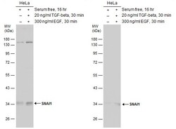 Invitrogen SNAIL Polyclonal Antibody 100 &mu;L; Unconjugated:Antibodies,