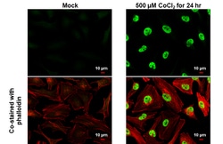 Invitrogen HIF1A Polyclonal Antibody 100 &mu;L | Buy Online | Invitrogen&trade; | Fisher Scientific