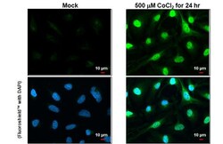 Invitrogen HIF1A Polyclonal Antibody 100 &mu;L | Buy Online | Invitrogen&trade; | Fisher Scientific