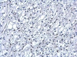 Invitrogen HIF1A Polyclonal Antibody 100 &mu;L | Buy Online | Invitrogen&trade; | Fisher Scientific