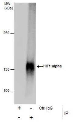 Invitrogen HIF1A Polyclonal Antibody 100 &mu;L | Buy Online | Invitrogen&trade; | Fisher Scientific