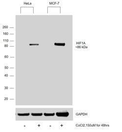 Invitrogen HIF1A Polyclonal Antibody 100 &mu;L | Buy Online | Invitrogen&trade; | Fisher Scientific