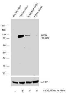Invitrogen HIF1A Polyclonal Antibody 100 &mu;L | Buy Online | Invitrogen&trade; | Fisher Scientific